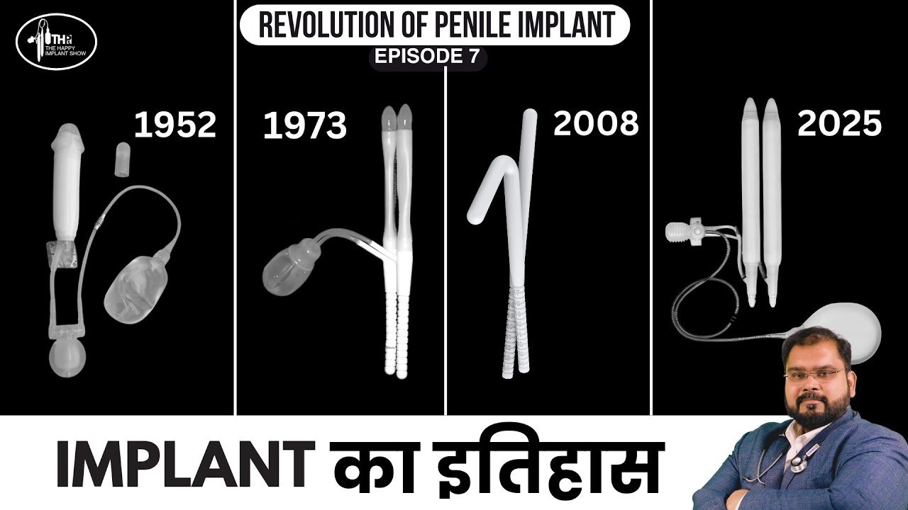ठोकन मशीन का इतिहास | History of Penile