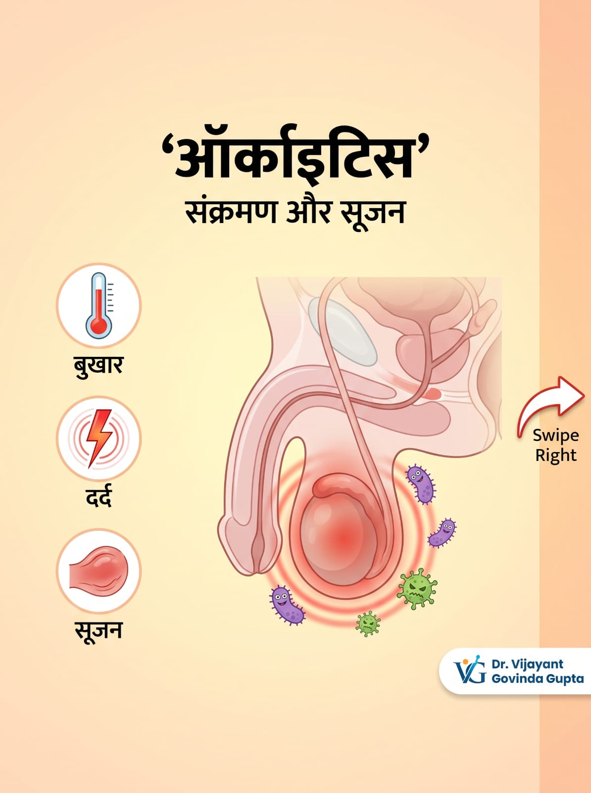 nfection: Epididymitis, Orchitis और “अंडकोष में संक्रमण”