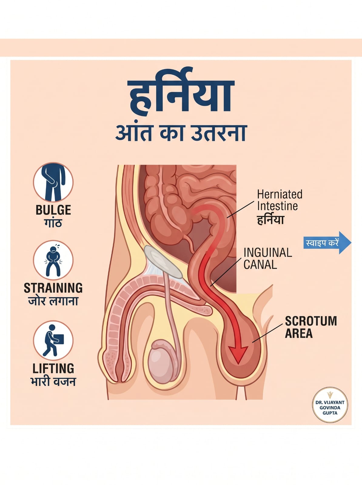 harniya symptoms